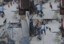 दिल्ली में आवारा कुत्ते का आतंक: 18 महीने के मासूम के चेहरे को नोचा, ICU में हालत नाजुक; दिल दहलाने वाला CCTV आया सामने